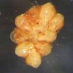 Dinocheirus panzeri egg mass