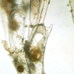 W_bryozoan_1a