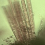 More diatoms on filamentous alga.