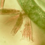 Diatoms on filamentous alga