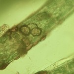 Diatoms on filamentous alga
