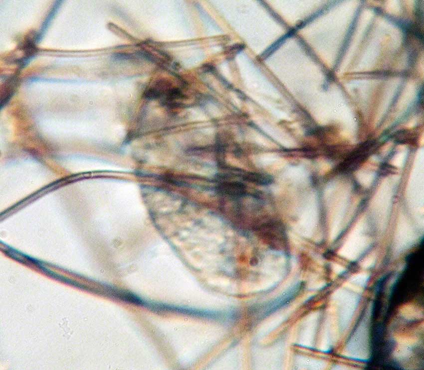 Ciliate among filaments of Cyanobacterial filaments