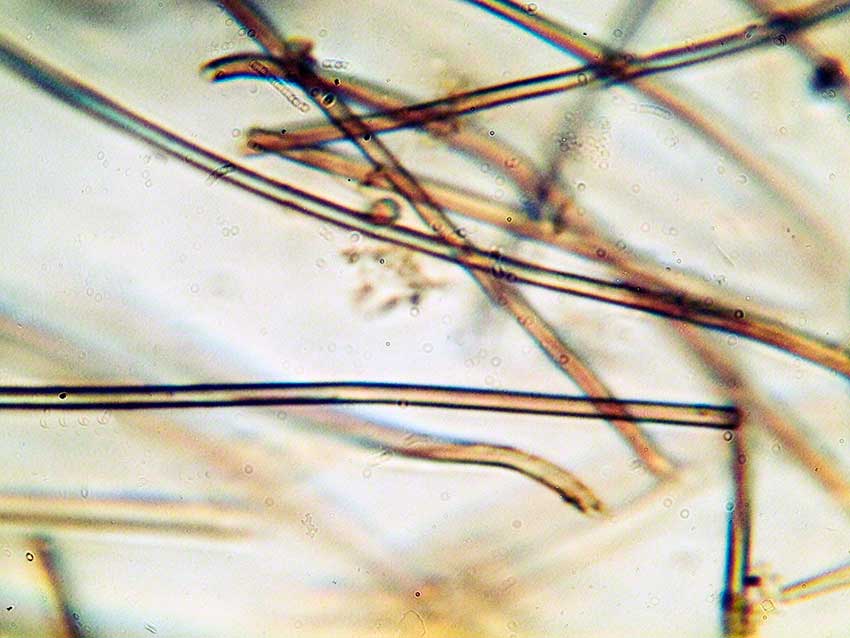 Cyanobacterial filaments