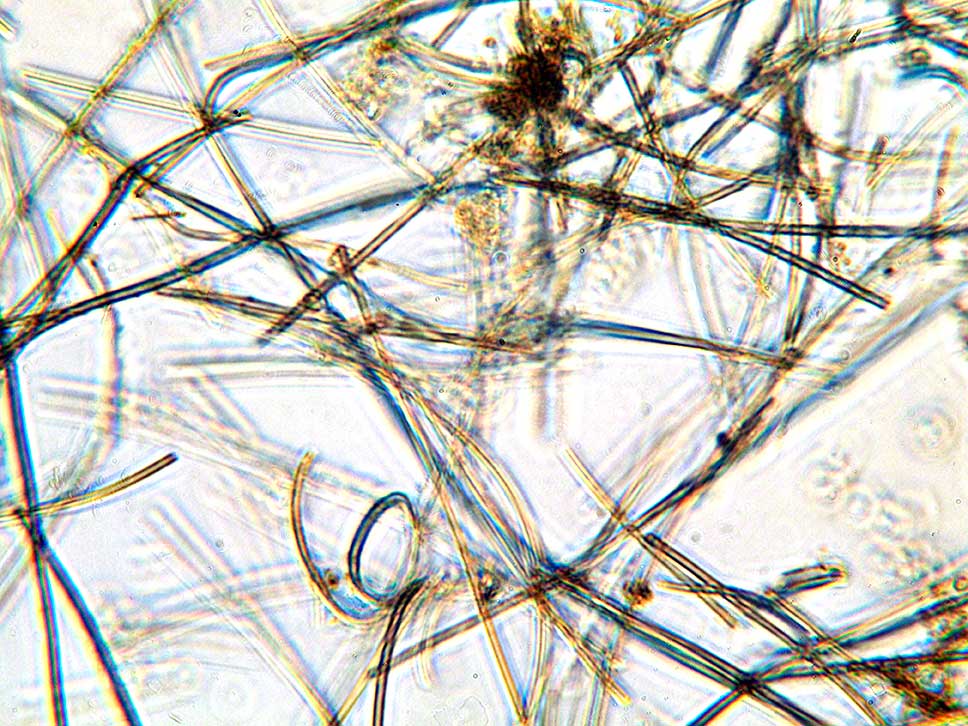 Cyanobacterial filaments