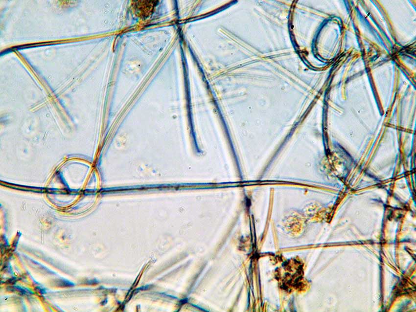 Cyanobacterial filaments