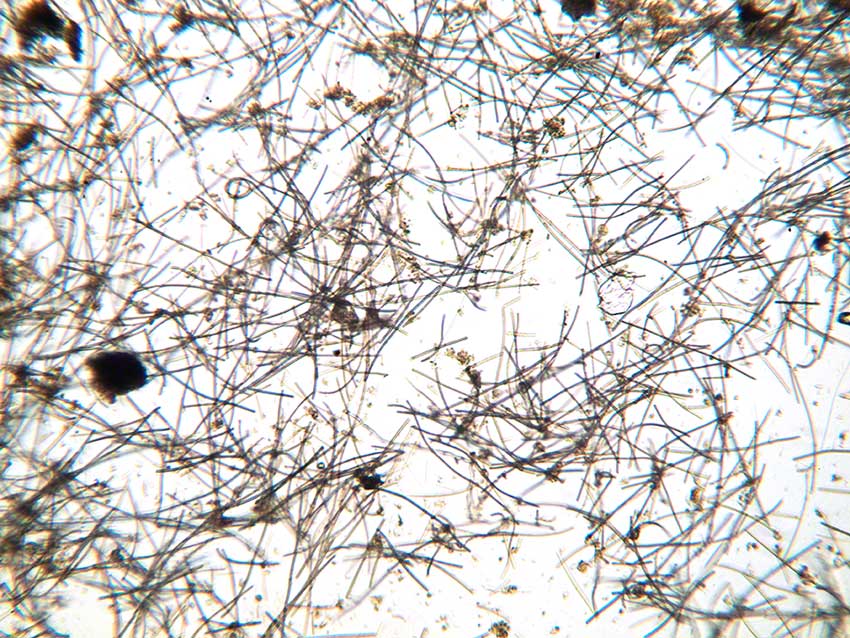 Cyanobacterial filaments