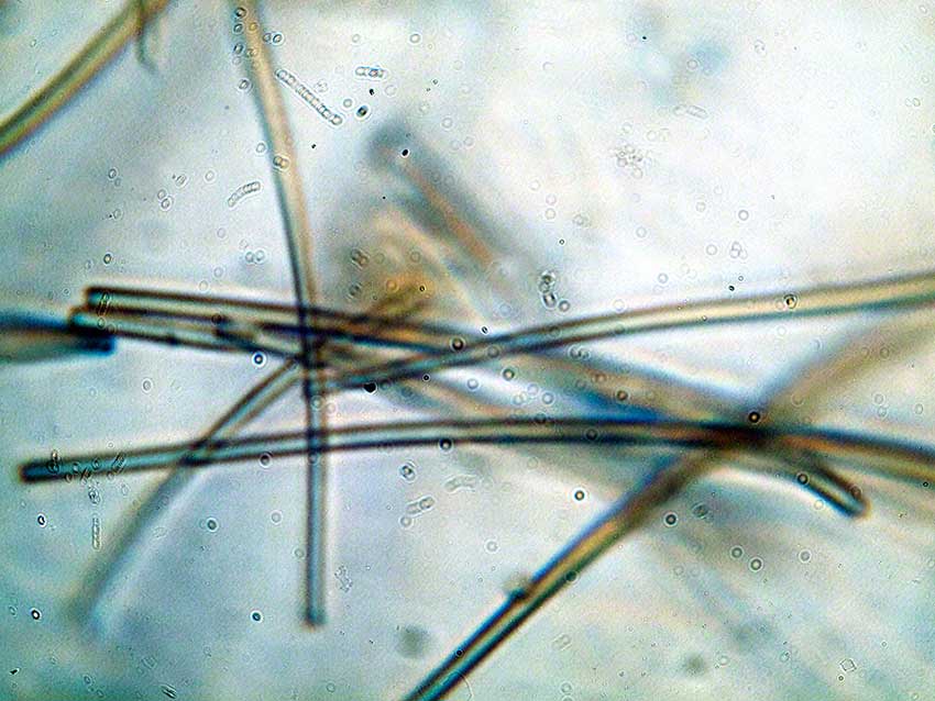 Cyanobacterial filaments