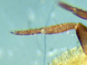 Allochernes wideri tarsus of leg IV